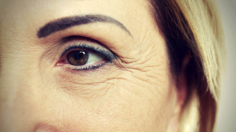 Καλές Γραμμές και Wrinkles: Αιτίες, Πρόληψη, και στρατηγικές θεραπείας