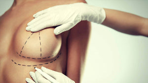 Breast Lift without Implants: All Your Options Reviewed for Effectiveness