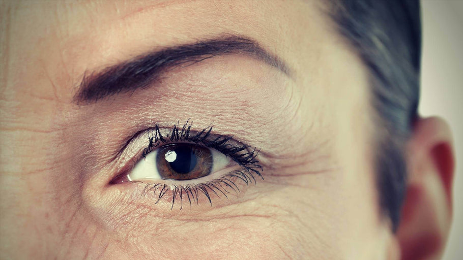 Under Eye Wrinkle Treatment: Options, Side Effects, and Natural Alternatives
