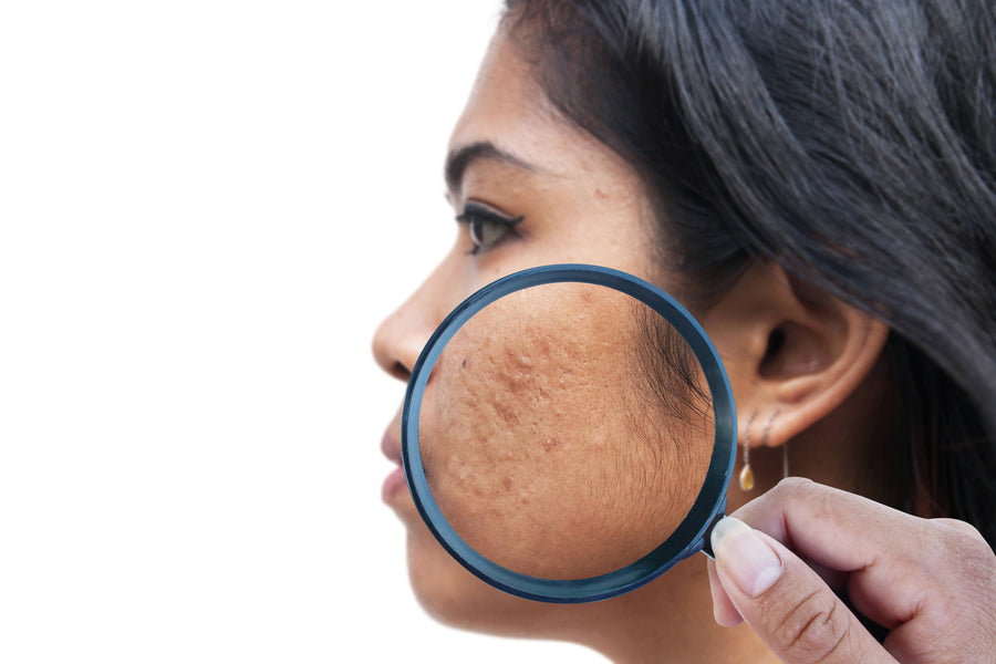 Trasforma la tua pelle: elimina le macchie scure sul viso