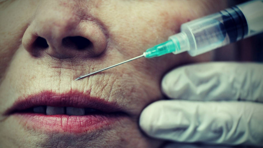 Upper Lip Wrinkles: Popular Remedies, Their Drawbacks, and Natural Alternatives